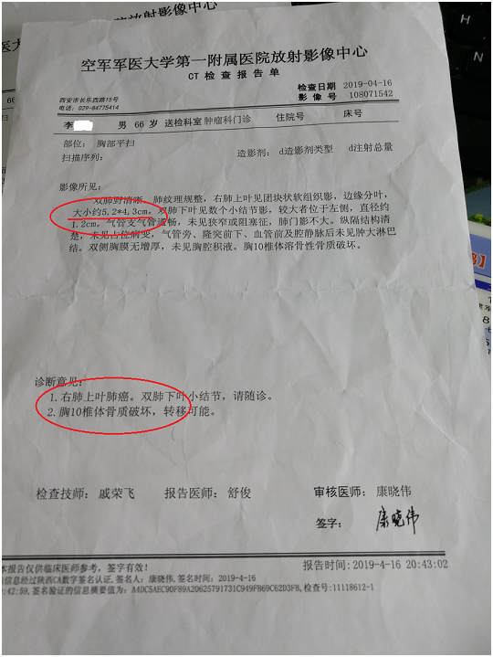 图2为病理的基因检测,未见 肺癌 相关基因突变,对靶向药不敏感.