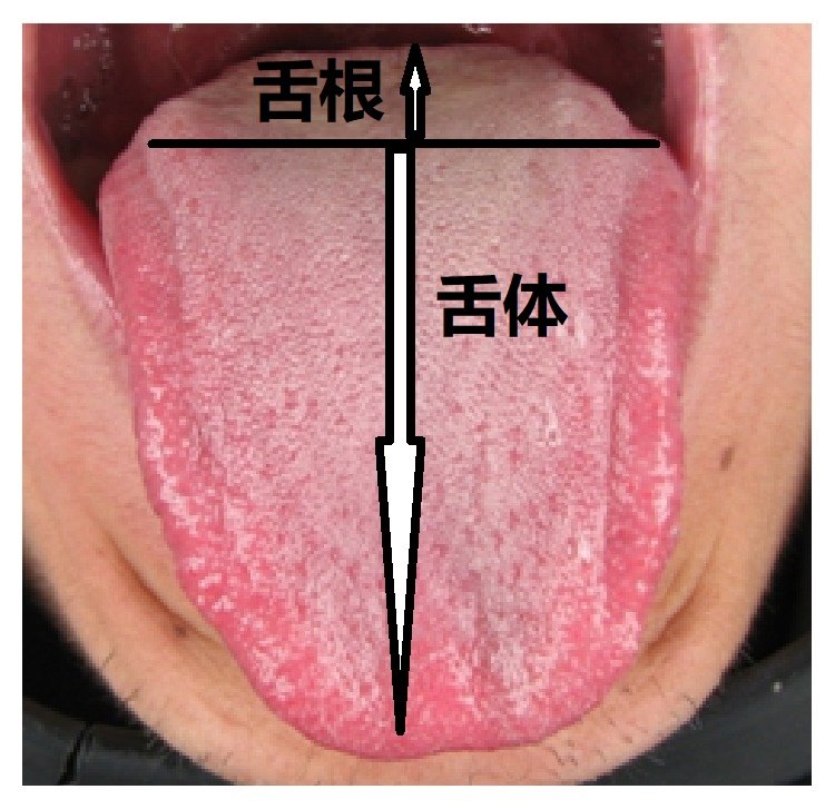在诊治过程中常有患者提出这样的疑虑:"我得的是舌癌,长在嘴里边,为啥
