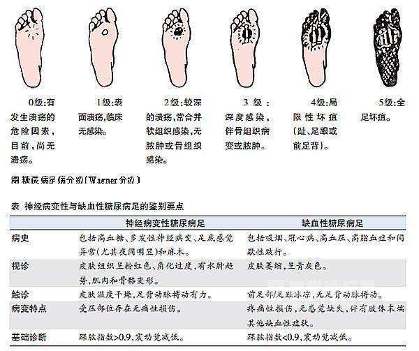 糖尿病足(溃疡,坏死)治疗经验分享——怎么让糖足患者