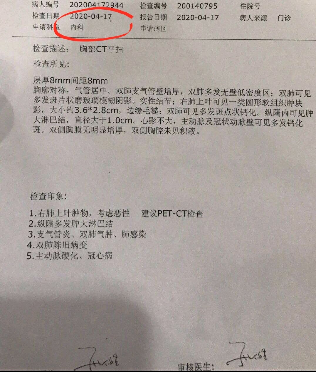 当时就做了pet-ct,结果考虑是肺癌