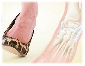 崴脚疼痛之--踝关节软骨损伤的危害和临床表现