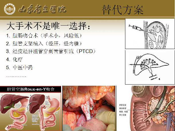 胰十二指肠切除术手术须知(附多图)