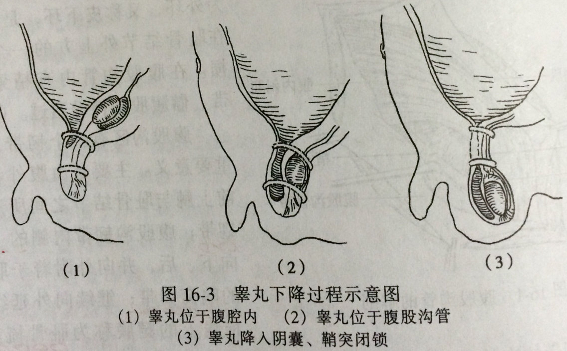 小儿腹股沟斜疝诊治的问与答_小儿疝气_小儿疝气手术
