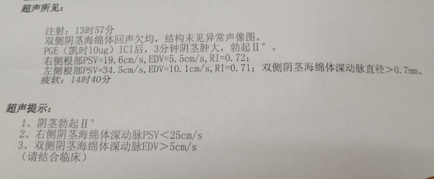 2,海绵体血管造影检查检查阴茎回流静脉包括阴茎背浅,深静脉,阴茎脚