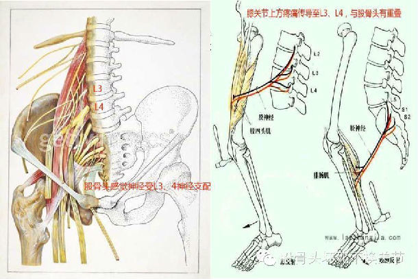 造成这种错觉的原因在于,股骨头感觉神经和腰部,膝关节神经感觉区