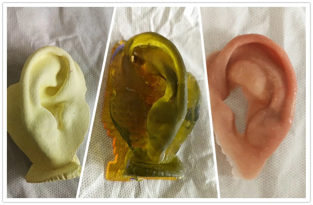 我用3d技术打印了一只耳朵_小耳畸形 - 好大夫在线
