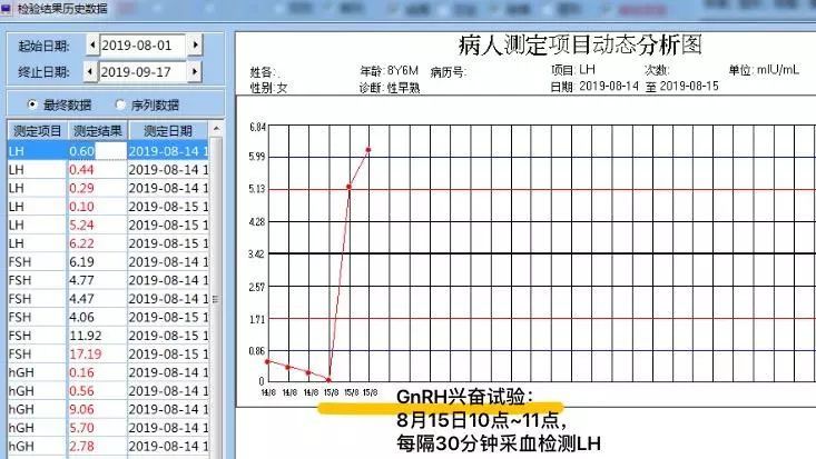 激发试验与测试结果: 1,戈那瑞林激发试验【gnrh兴奋试验:通过体外