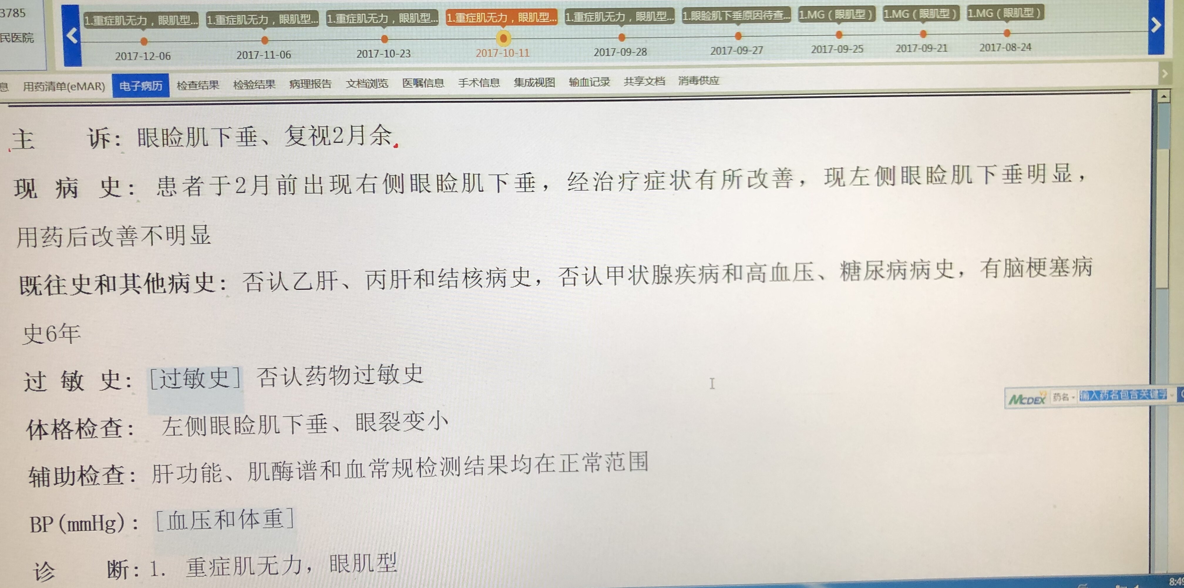 老李的眼睑肌下垂话说重症肌无力