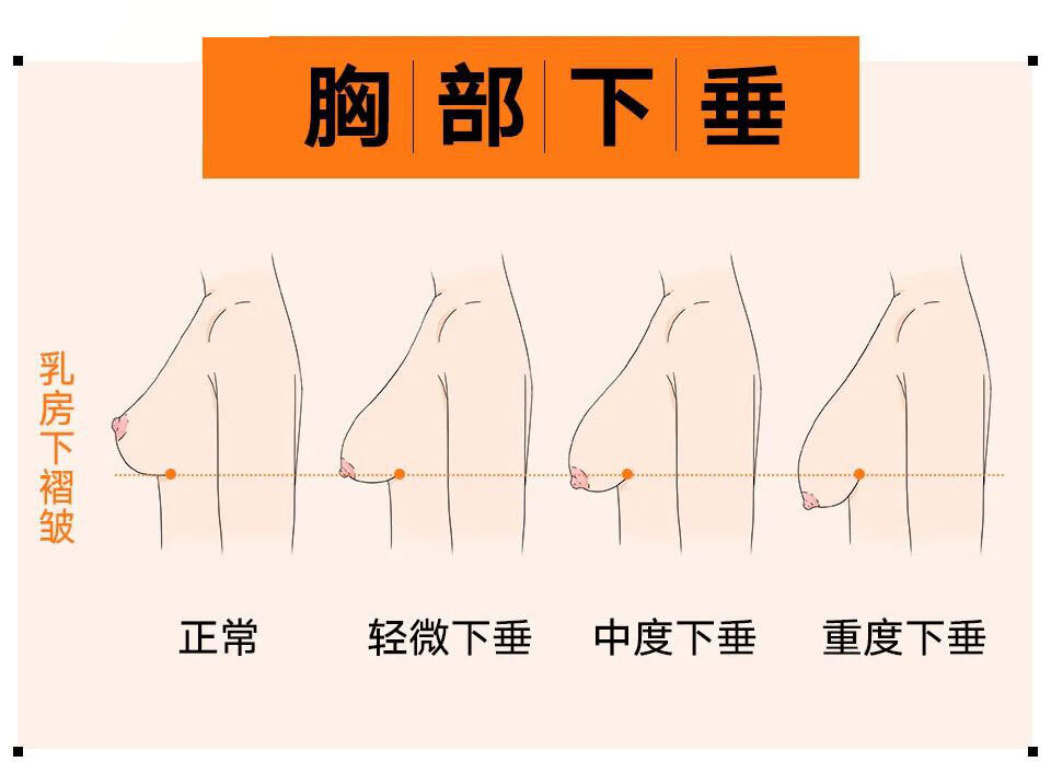 5,过热的水洗澡导致胸部下垂 过热的水会烫去皮肤表面的