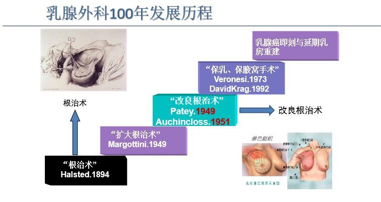 乳腺癌手术方式有哪些,如何选?