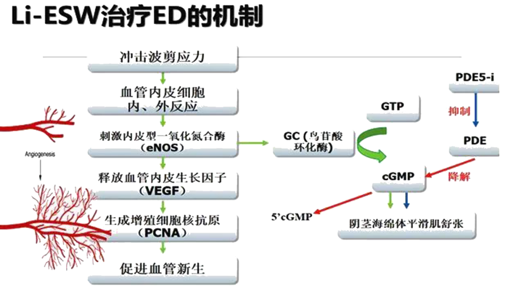 男性健康低能量体外冲击波ed1000在男性疾病中的应用