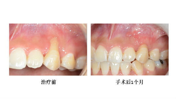 成功的手术案例