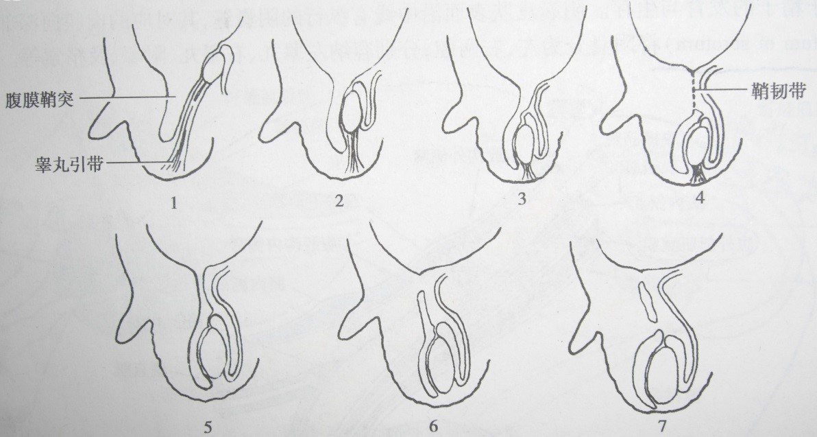 小儿腹股沟疾病(1):睾丸下降的正常发育生物学过程和相关异常的基本