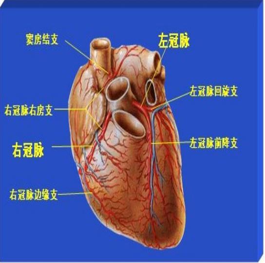 冠状动脉粥样硬化性心脏病简称冠心病,是由于冠状动脉粥样硬化,官腔
