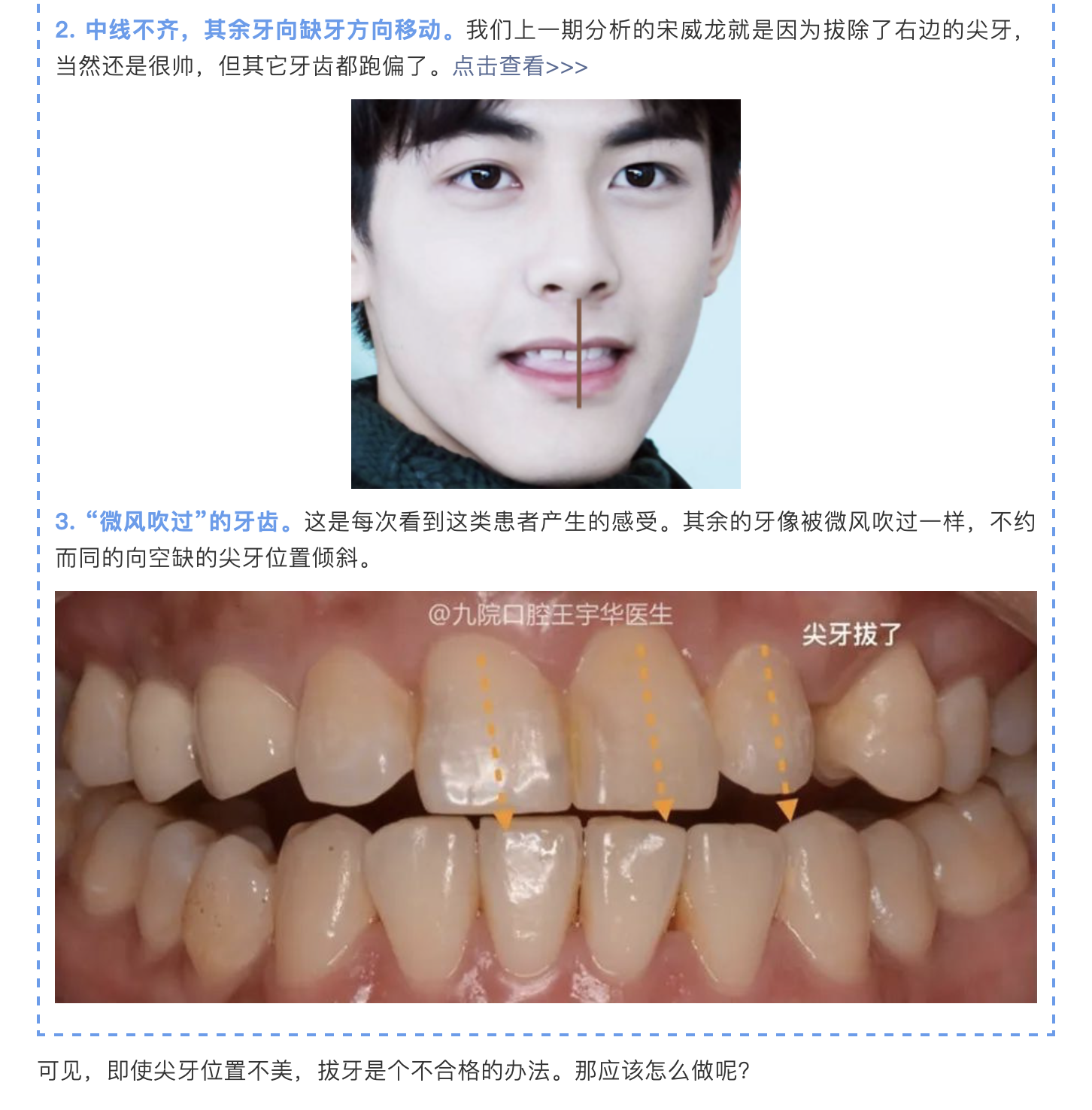 不整齐的鲍牙小虎牙需要怎么处理已经烤瓷了怎么办呢