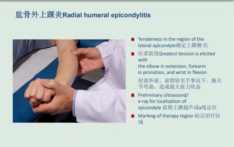 冲击波治疗学习之二肱骨外上髁炎