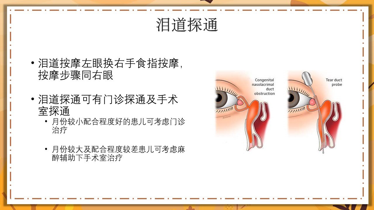 先天性泪道阻塞,泪道按摩的几件事