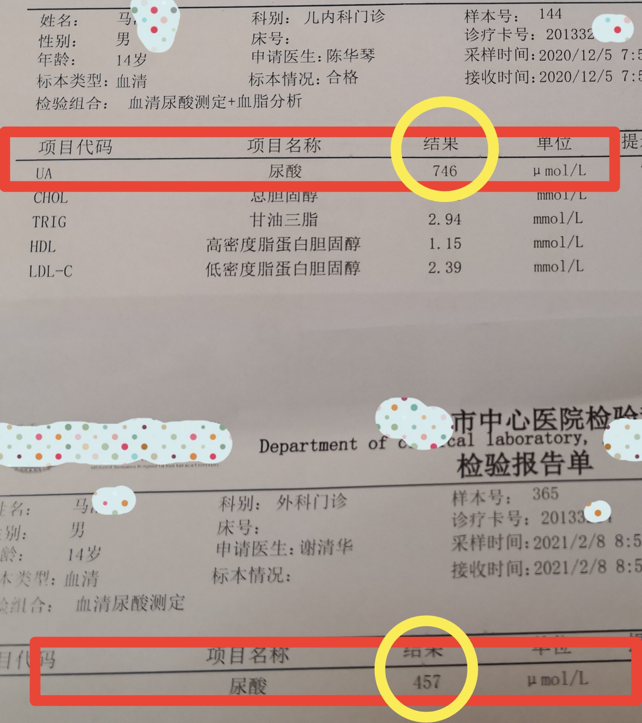 成永明蜂疗加膏方降尿酸治痛风病例报道