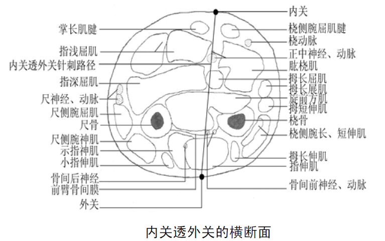 若患者在透刺后,做屈肘,屈腕,屈掌指关节,屈指间关节,旋前时,前臂前群