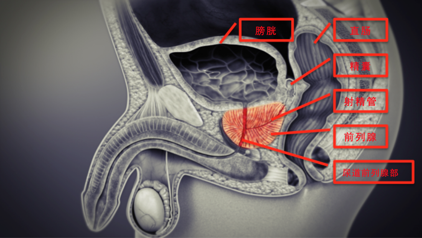 前列腺的两侧有神经血管束,里面走行着控制阴茎勃起的性神经及相关