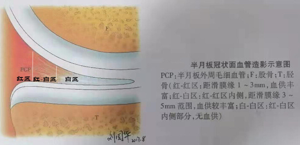 带你解读半月板损伤