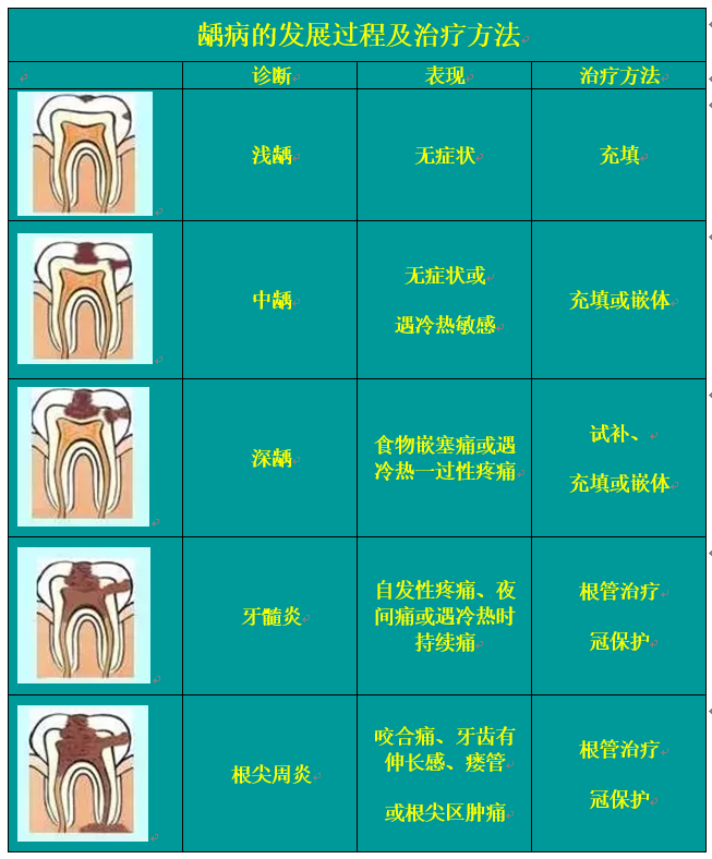 科普牙齿根管治疗,让看牙补牙无忧!