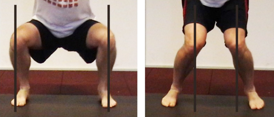 左图为正确下蹲姿势,右图出现了"x"形腿,易损伤膝关节