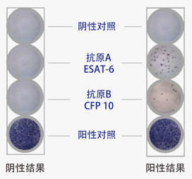 tspot阳性就是肺结核吗