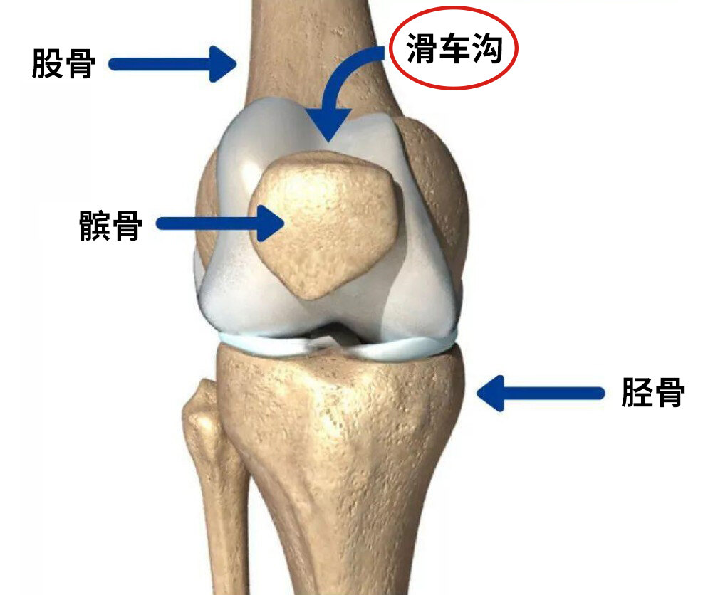 髌骨是影响人类双足直立行走的重要籽骨,也是人体最大的籽骨,位于膝