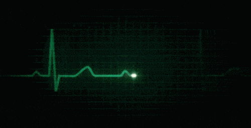 当前位置:></p></a>好大夫在线>幺天保> 常见心律失常:心动过缓与心脏骤停由于