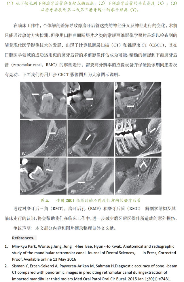 磨牙后区的隐形杀手——下颌磨牙后管