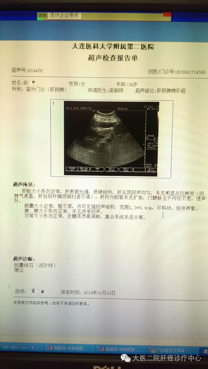 上图是治疗后8个月的超声,提示 胆囊结石 已经变成泥沙样的.