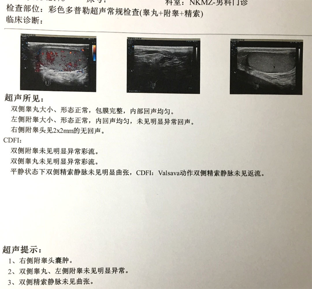 附睾囊肿需要割蛋蛋么