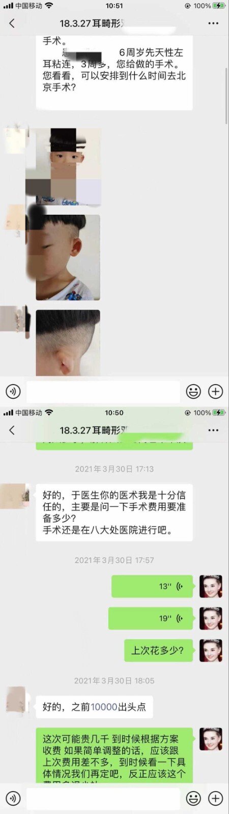 小耳畸形舒展修复手术后耳朵可以长大