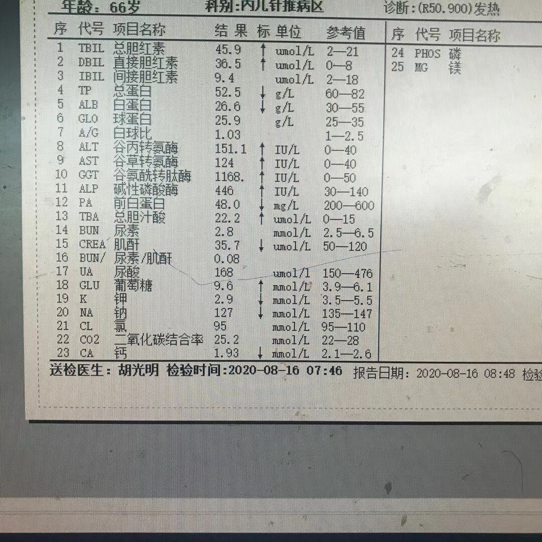 肝胆管细胞癌术后,肝硬化,肝腹水治疗