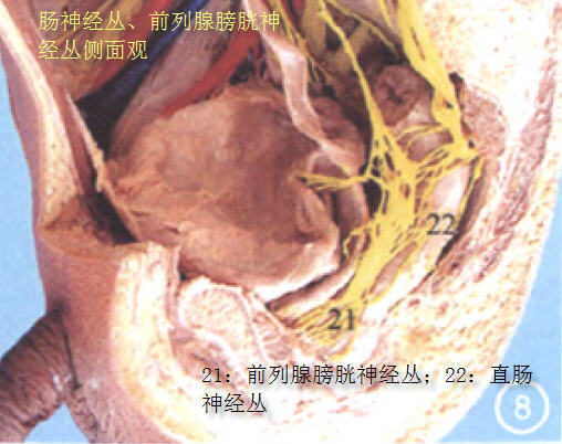 上腹下丛下行至骶骨下部前方并接纳盆内脏神经而形成盆丛,盆丛位于