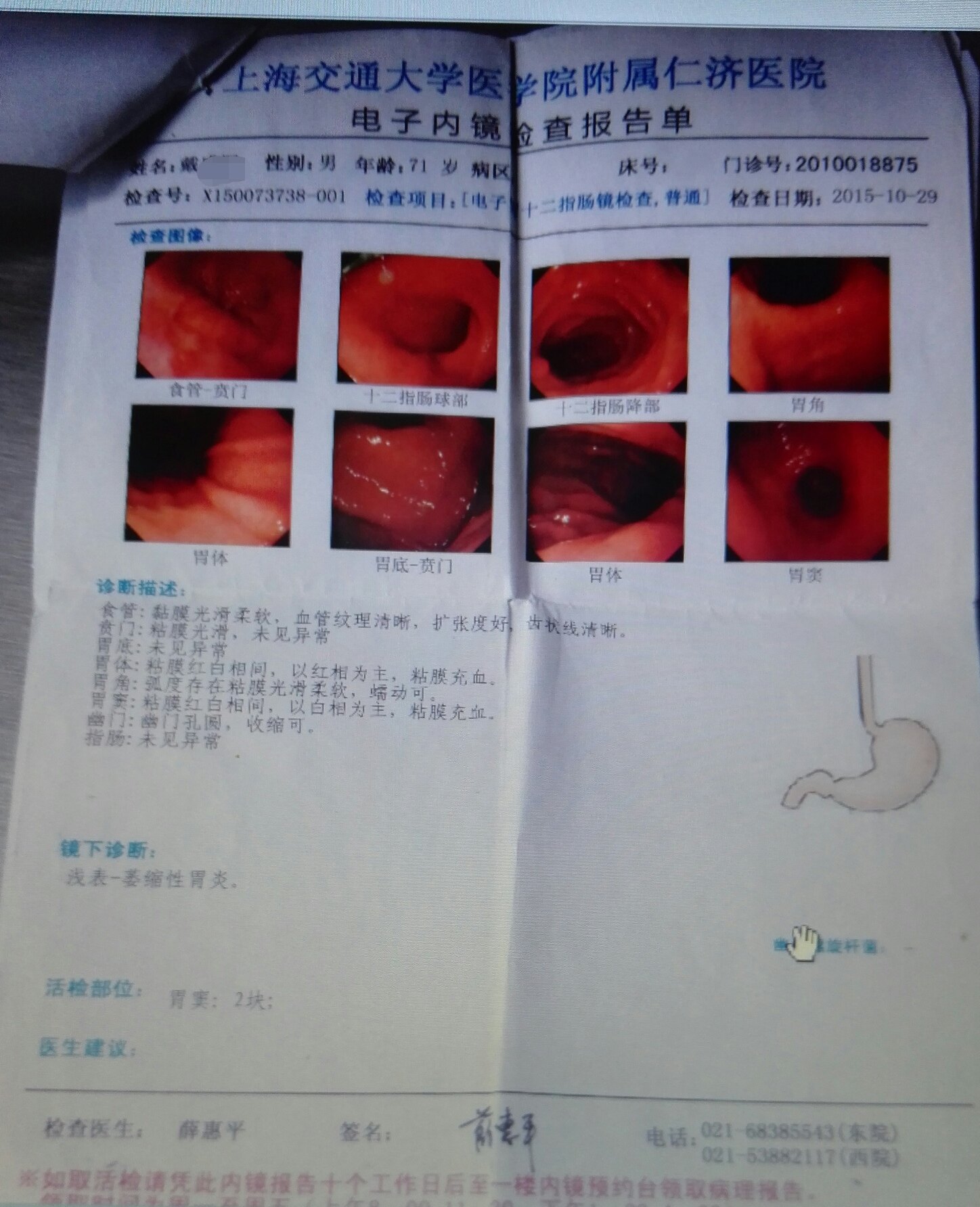 一例中度萎缩和肠化,伴异型增生的胃炎患者的治愈经过