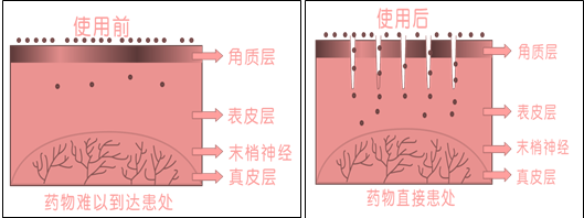 说明: 原理22（透明底）