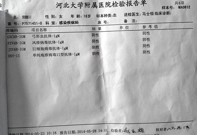 传染性单核细胞增多症4例体会