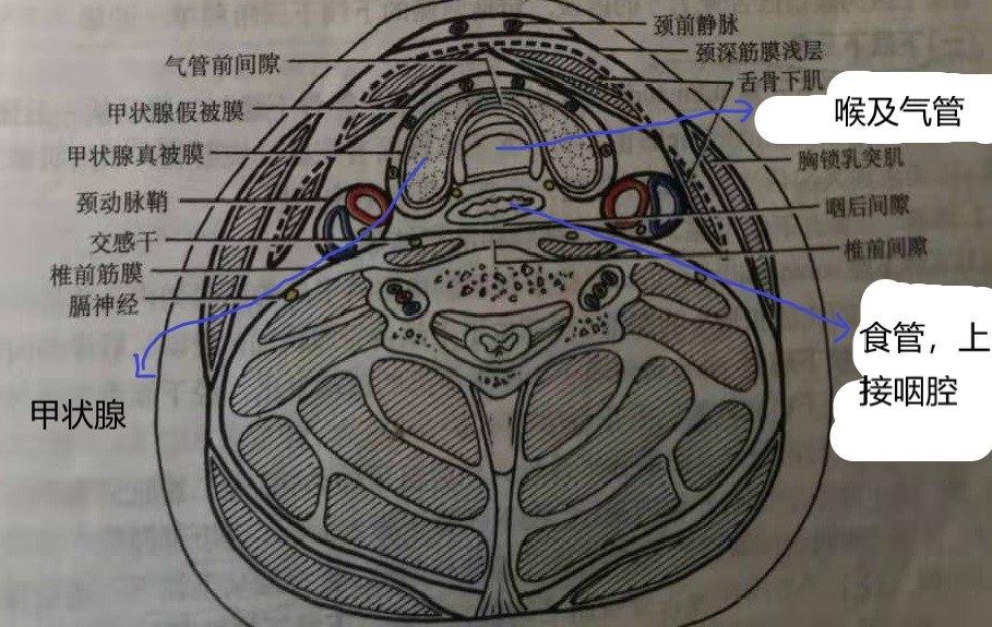 还有甲状腺,两侧有颈动脉鞘,颈动脉鞘里就有颈