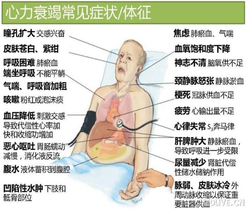 一分钟了解心力衰竭的临床表现