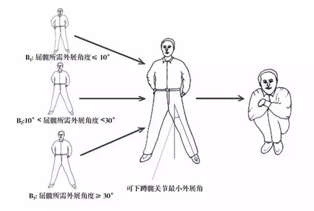 臀肌挛缩解决方案