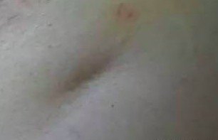 医生,我会不会是乳腺癌啊?