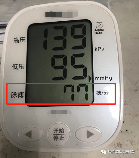 電子血壓計上的心率沒大家想的那麼準確