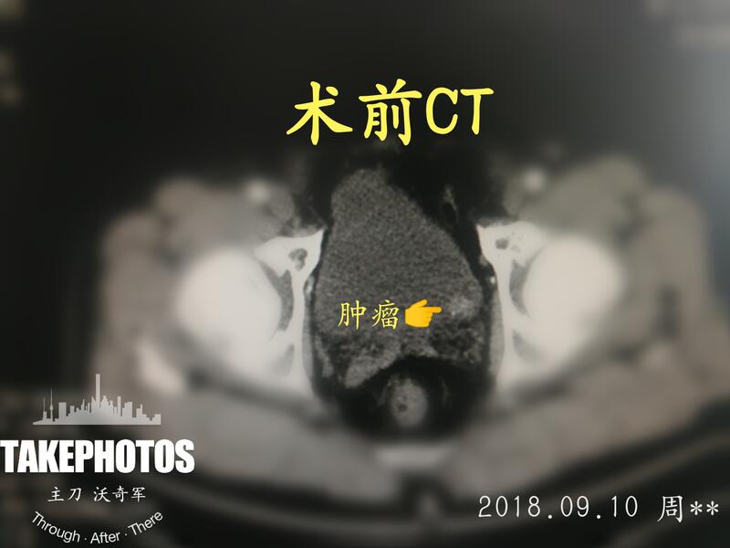 圖文圖片