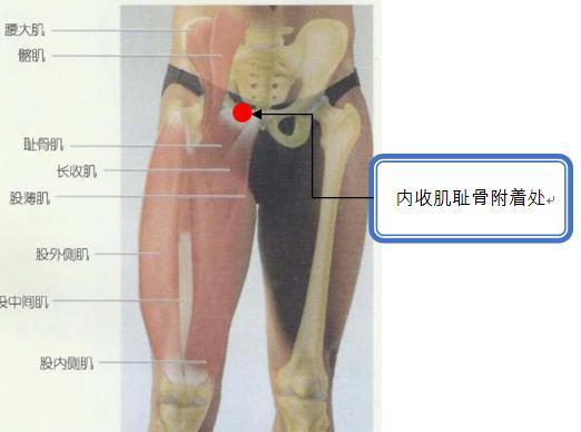 内收肌耻骨附着处痛点.jpg