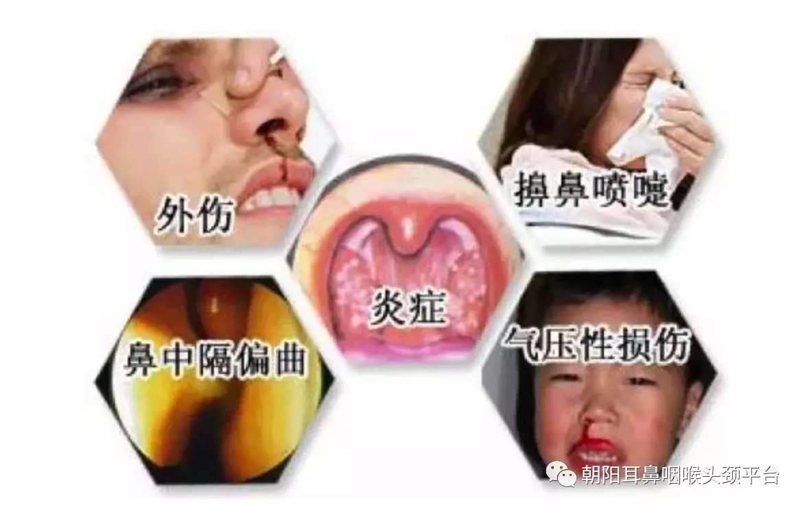 暂无