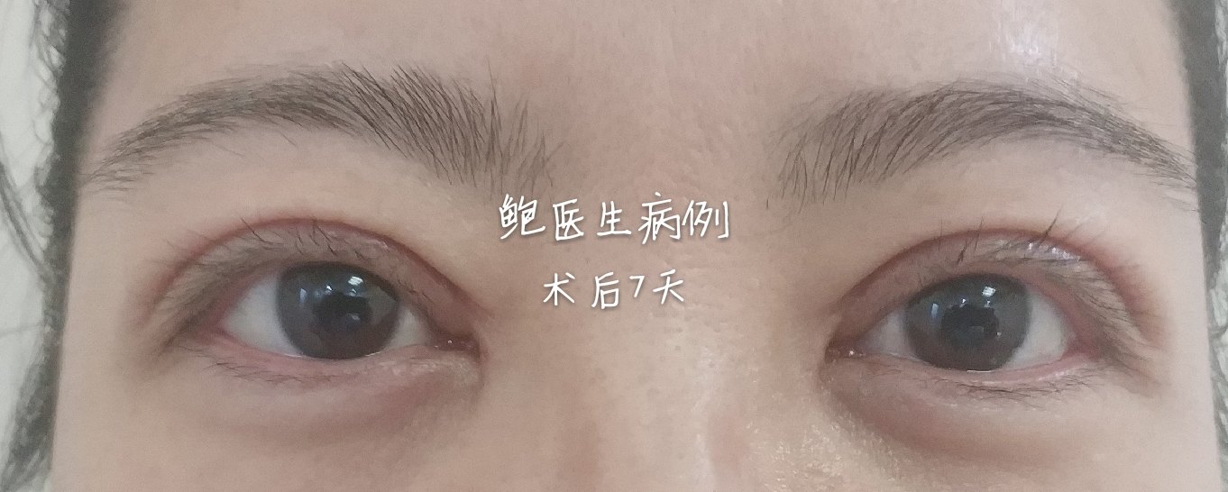 暂无