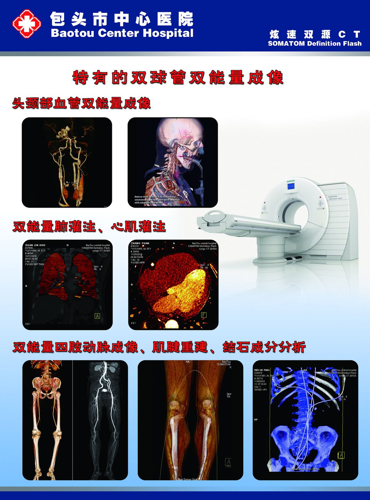 炫速双源ct图片