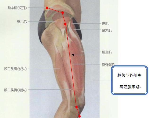 膝关节外侧疼痛思路.jpg